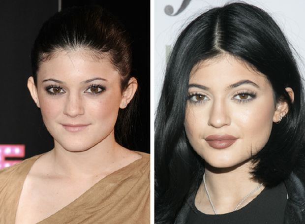 kylie