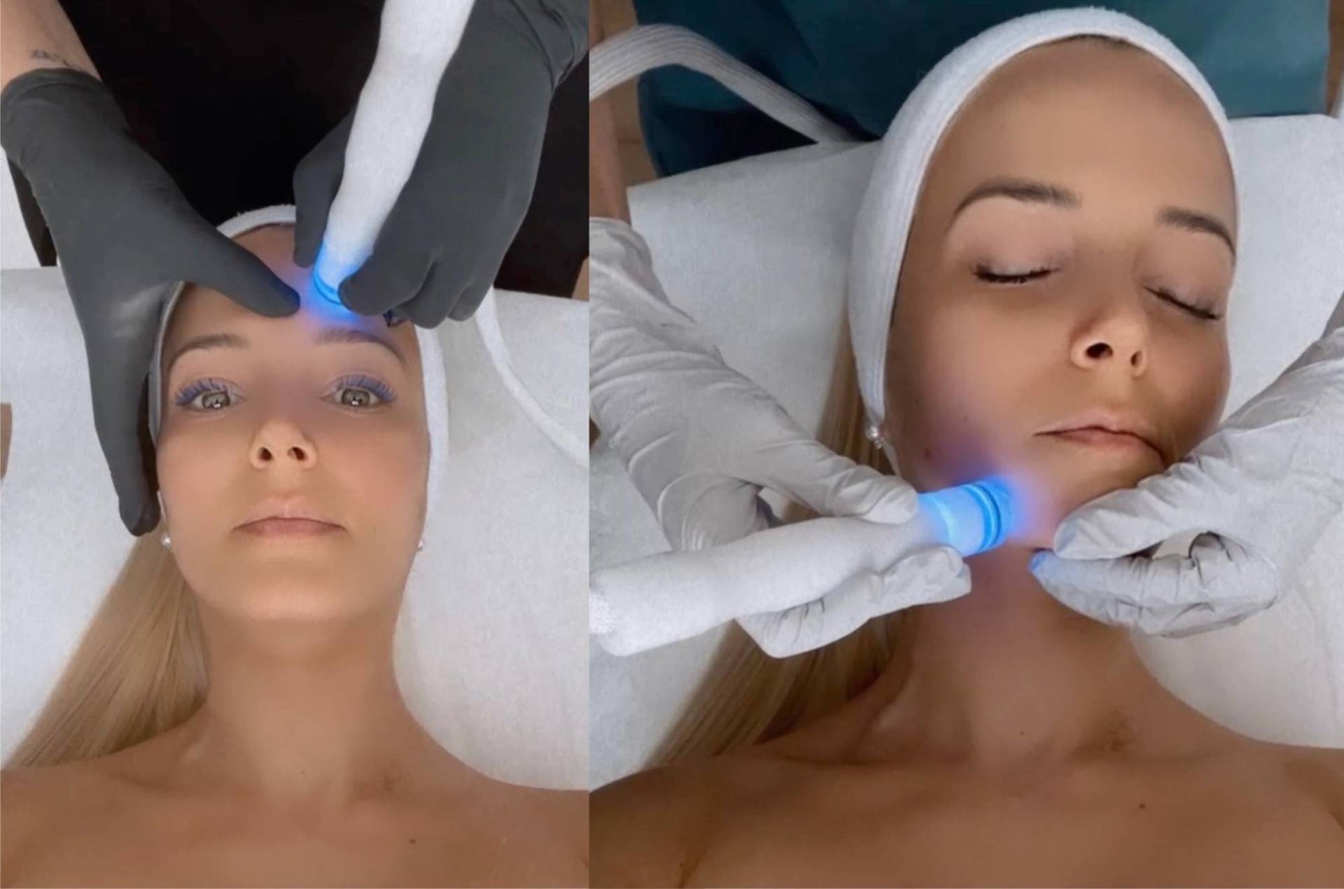 Aqua Derm Photo