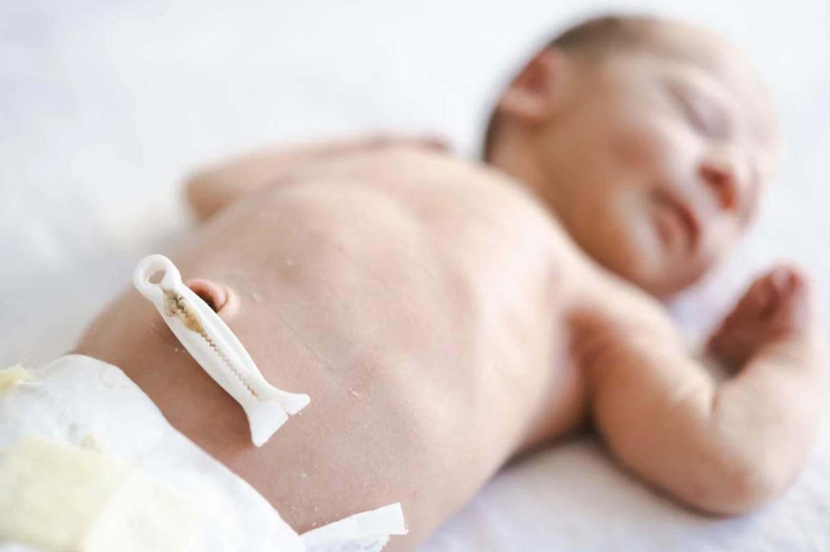 Umbilical Cord1