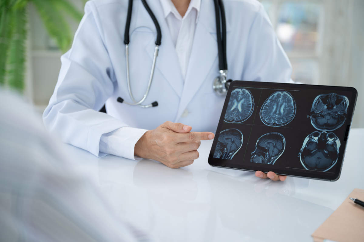 Neurologist Doctor Treatment Planning For Diseases Nervous System And Brain With Patient About Cerebrovascular Disease, Migraine, Parkinson's Disease, Dementia And Stroke At Neurology Center.